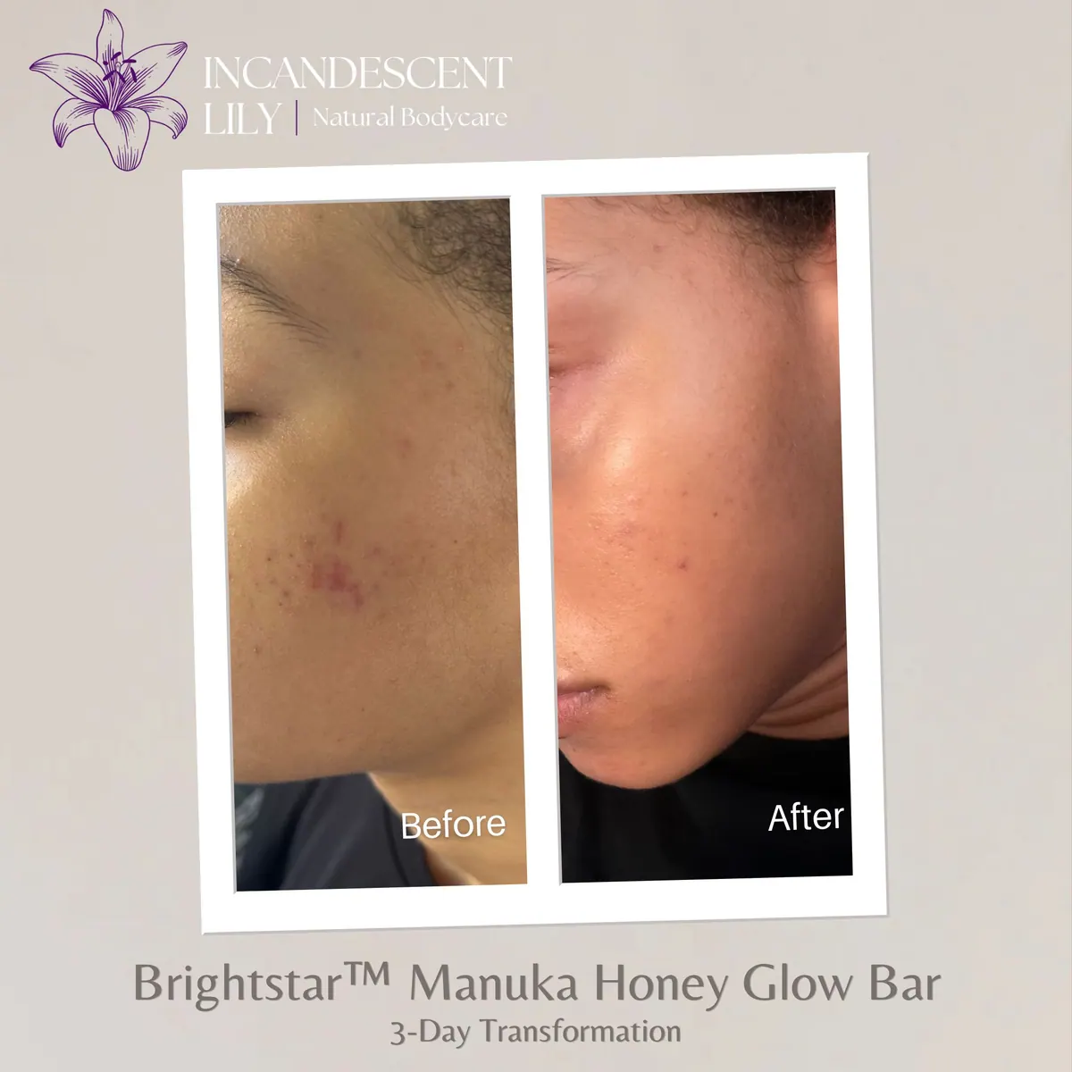 Brightstar™ Manuka Honey Glow Bar — image 2