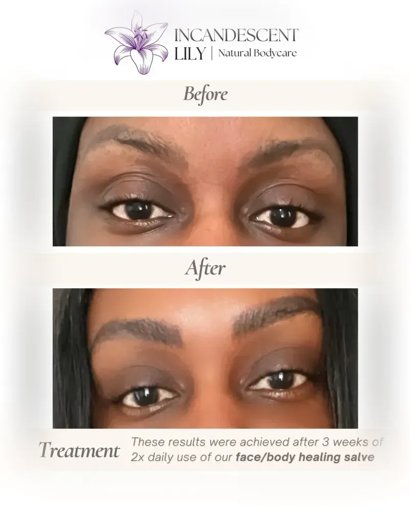 Before and after: Whole Body Healing Salve, 3 weeks · twice daily