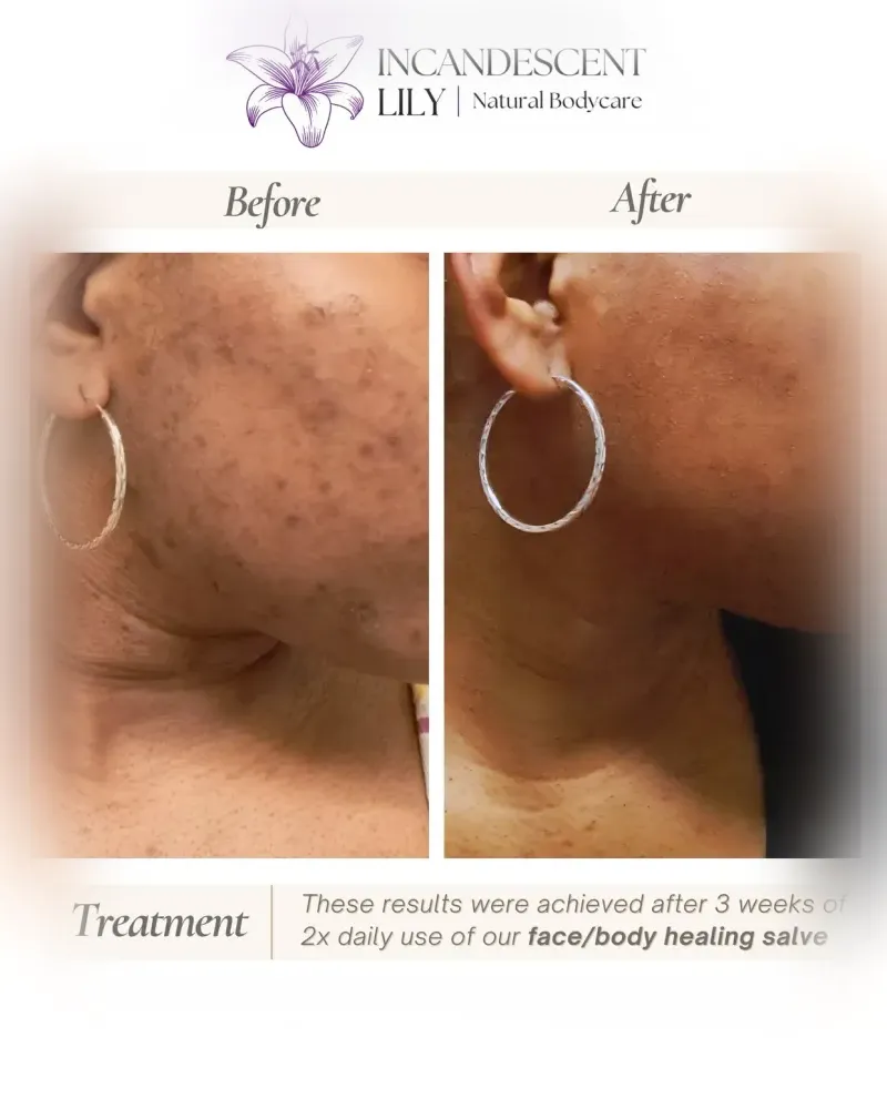 Before and after: Whole Body Healing Salve, 3 weeks · twice daily