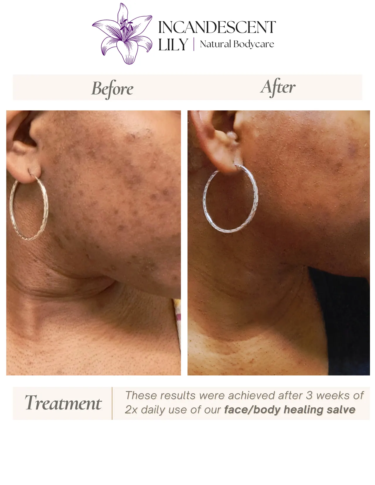 Glow & Grow Duo — image 2